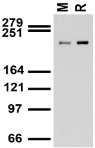 ANK2 / Ankyrin B Antibody (clone S105-13)