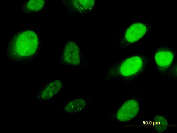 HOXD3 Antibody (clone 1B12)