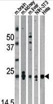 Polyclonal Rabbit anti-Human PARK7 / DJ-1 Antibody (aa1-30, IF, WB)