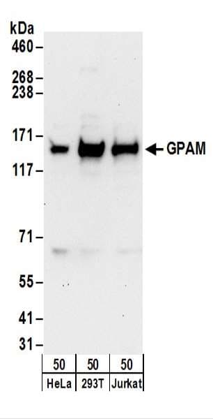 Polyclonal Rabbit anti-Human GPAM Antibody (aa275-325, WB)