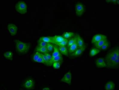 Polyclonal Rabbit anti-Human KCNJ10 / SESAME / KIR4.1 Antibody (aa165-379, IHC)