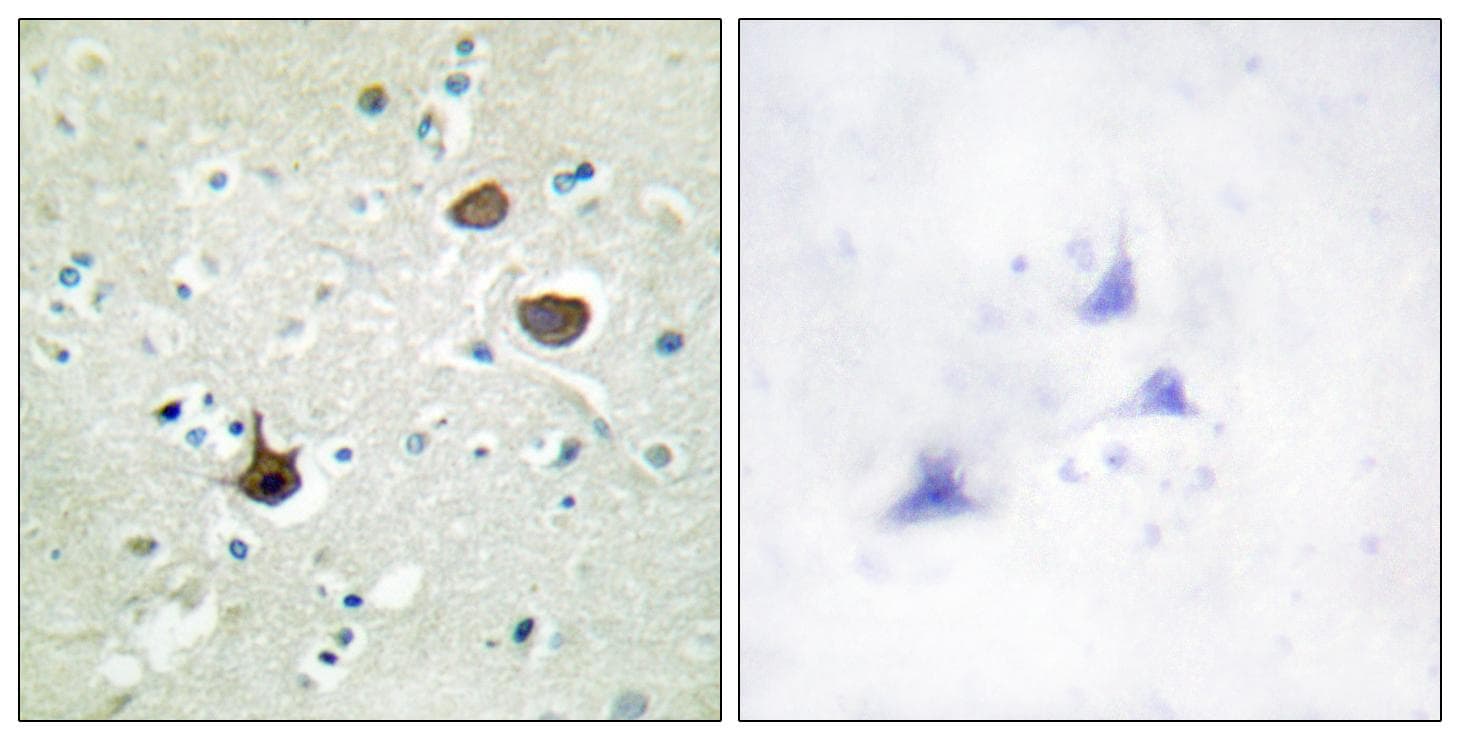 Polyclonal Rabbit anti-Human CXCR4 Antibody (phospho-Ser339, IHC, IF, WB)