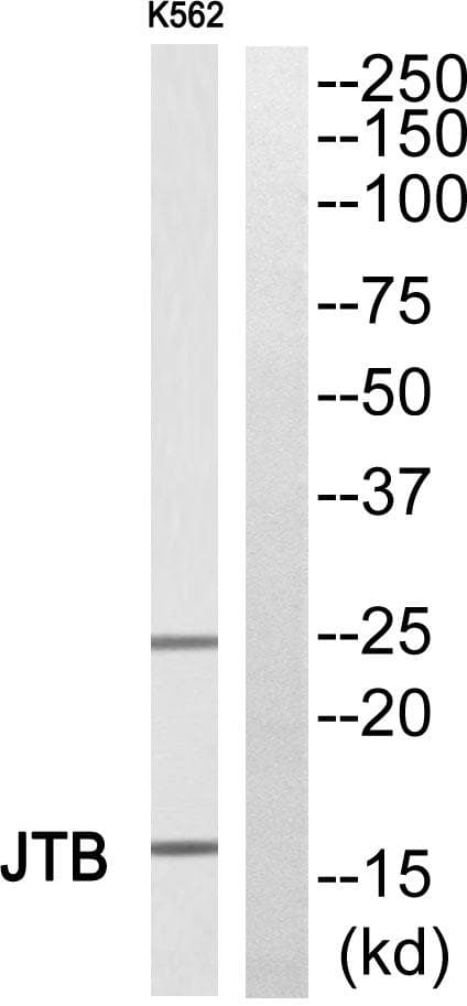 Polyclonal Rabbit anti-Human JTB / PAR Antibody (WB)