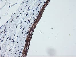 OTUB1 / OTU1 Antibody (clone OTI1E3)