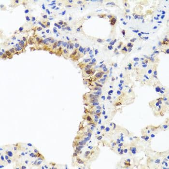 Polyclonal Rabbit anti-Human IL8 / Interleukin 8 Antibody (IHC)