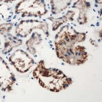 Polyclonal Rabbit anti-Human F12 / Factor XII Antibody (N-Terminus, IHC, WB)