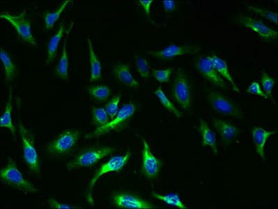 TSH Receptor / TSHR Antibody (aa21-413)