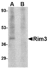Polyclonal Rabbit anti-Human RIMS3 Antibody (IHC, IF, WB)