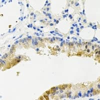 DCP2 Antibody