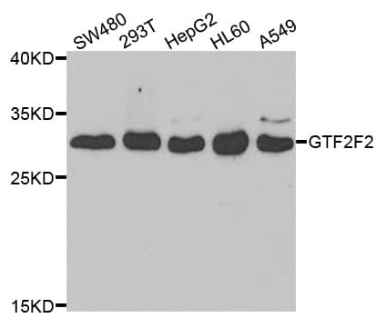 RAP30 / GTF2F2 Antibody