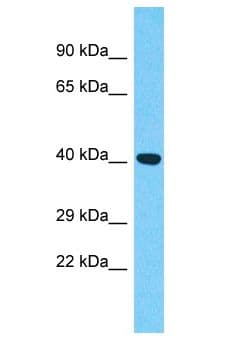 FLJ22028 Antibody (aa12-61)