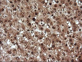 KLK8 / Kallikrein 8 Antibody (clone OTI2A5, Carrier-free)