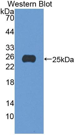 GGPS1 Antibody (aa78-258, Biotin)