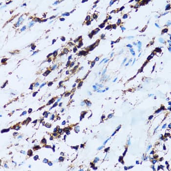 SPN / CD43 Antibody