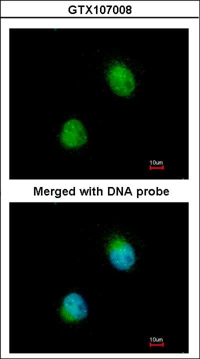 Polyclonal Rabbit anti-Human ZC3H8 Antibody (aa31-291, IHC, WB)