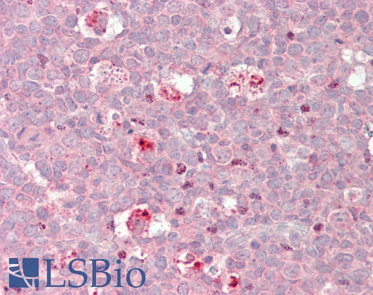 IHC-plus™ BIRC3 / cIAP2 Antibody (aa109-118)