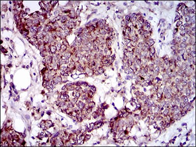 Monoclonal Mouse anti-Human MRPL42 / MRPS32 Antibody (clone 3H6H2, aa10-142, IHC, WB)