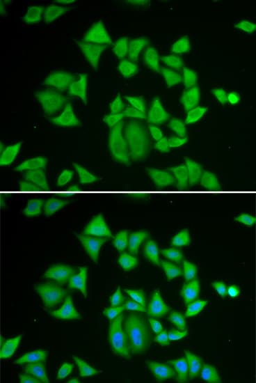 GSTM2 Antibody