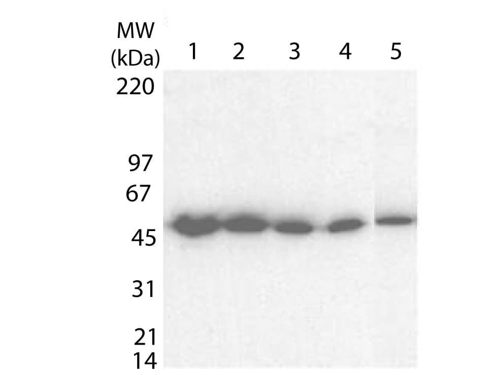 Tetanus Toxin Fragment C Antibody