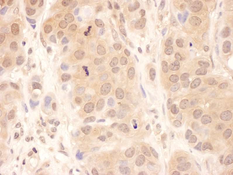 USP8 / UBPY Antibody (aa400-450)