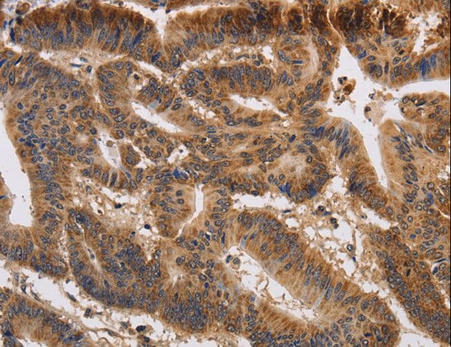 KCNK9 / TASK3 Antibody