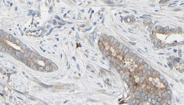 GPX1 / Glutathione Peroxidase Antibody