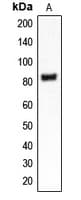 CLCN4 / CLC-4 Antibody (Internal)