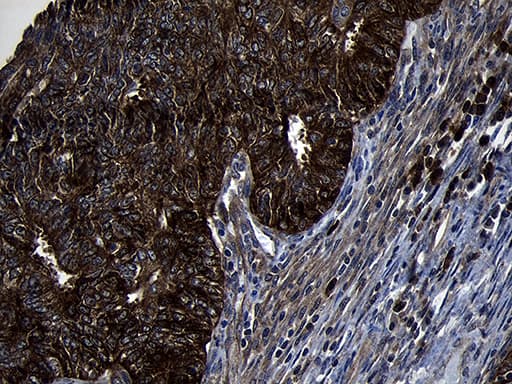 Monoclonal Mouse anti-Human PIKFYVE / PIP5K Antibody (clone OTI1A5, IHC, WB)