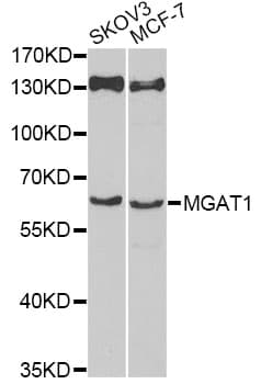 Polyclonal Rabbit anti-Human MGAT / GLYT1 Antibody (WB)