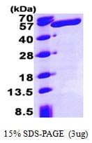 Human ALDH3A1 Protein (Recombinant His)