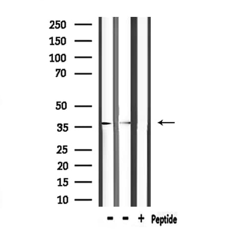 ANXA5 / Annexin V Antibody