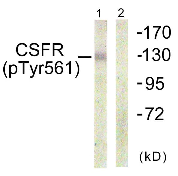 Polyclonal Rabbit anti-Human CSF1R / CD115 / FMS Antibody (phospho-Tyr561, IHC, WB)