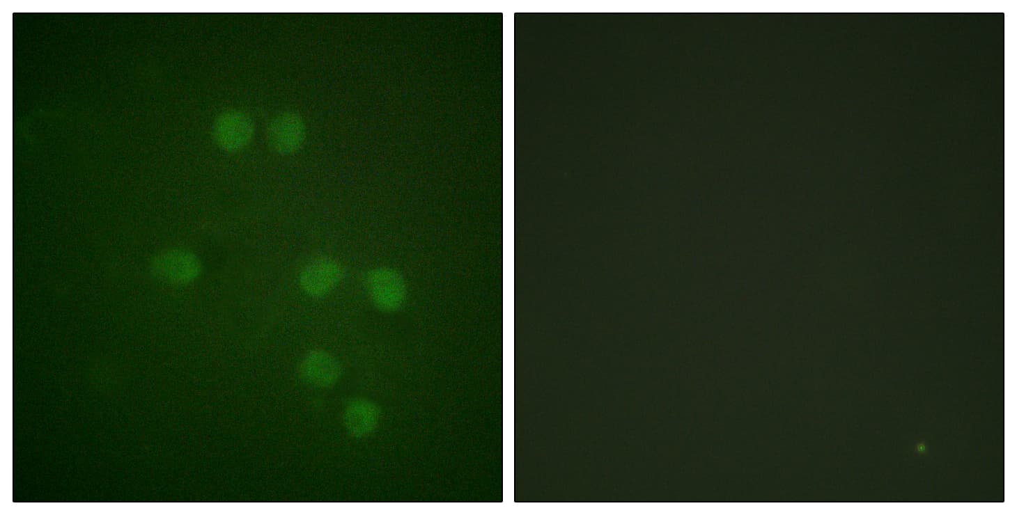Polyclonal Rabbit anti-Human HMGN1 / HMG14 Antibody (aa10-59, IF)