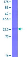 Human HOXA5 Protein (Recombinant GST, N-terminus)