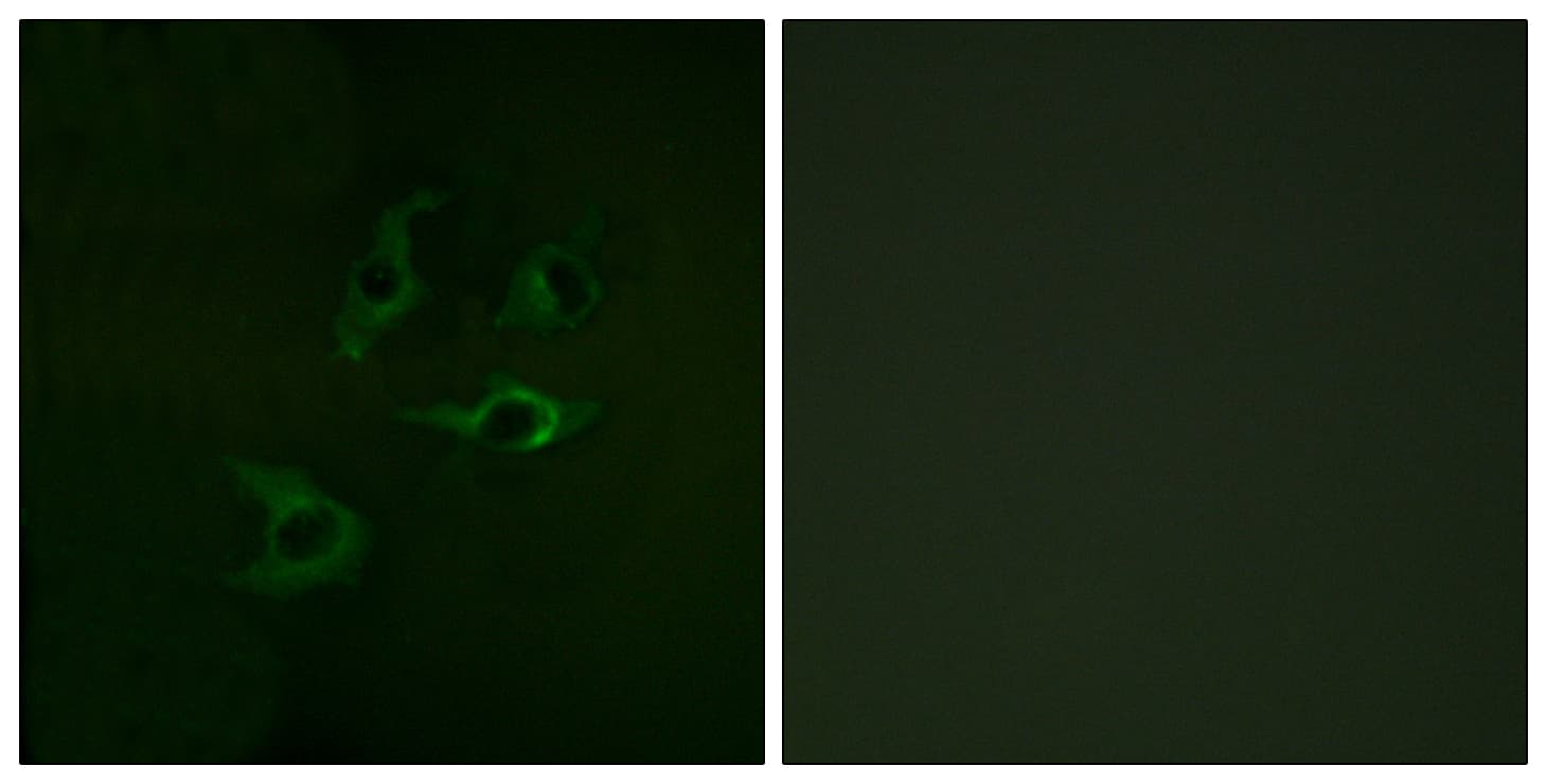 c-CBL Antibody (aa740-789)