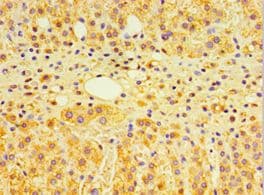 Polyclonal Rabbit anti-Human GTF2H2C Antibody (aa1-260, IHC)