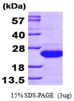 Human SAT1 / SAT Protein (Recombinant His)