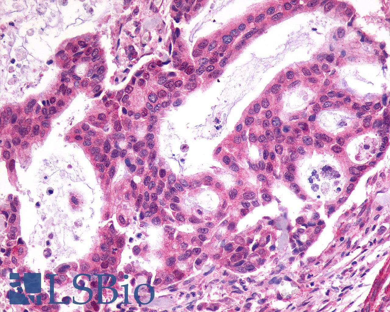 PathPlus™ Polyclonal Rabbit anti-Human SSTR1 Antibody (C-Terminus, IHC)