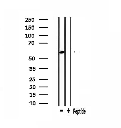 PDP2 Antibody