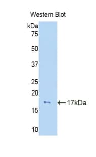 IL15 Antibody (aa49-162)