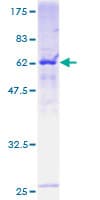 Human RFC5 Protein (Recombinant GST)
