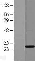 THAP6 Protein (Over-Expression Lysate Myc-DDK (Flag))