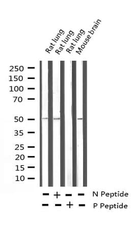CAMK2A / CaMKII Alpha Antibody (phospho-Thr286)