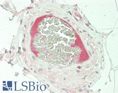 IHC-plus™ Polyclonal Rabbit anti-Human MASP2 / MASP-2 Antibody (aa209-258, IHC, WB)