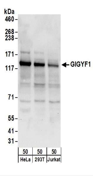Polyclonal Rabbit anti-Human GIGYF1 Antibody (aa350-400, WB)