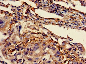 BCL2 / Bcl-2 Antibody