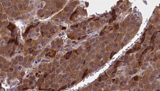 ITGB3 / Integrin Beta 3 / CD61 Antibody