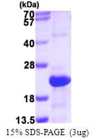 Human SRGN / Serglycin Protein (Recombinant His)