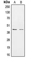 Polyclonal Rabbit anti-Human CSNK1E / CK1 Epsilon Antibody (Internal, IHC, IF, WB)