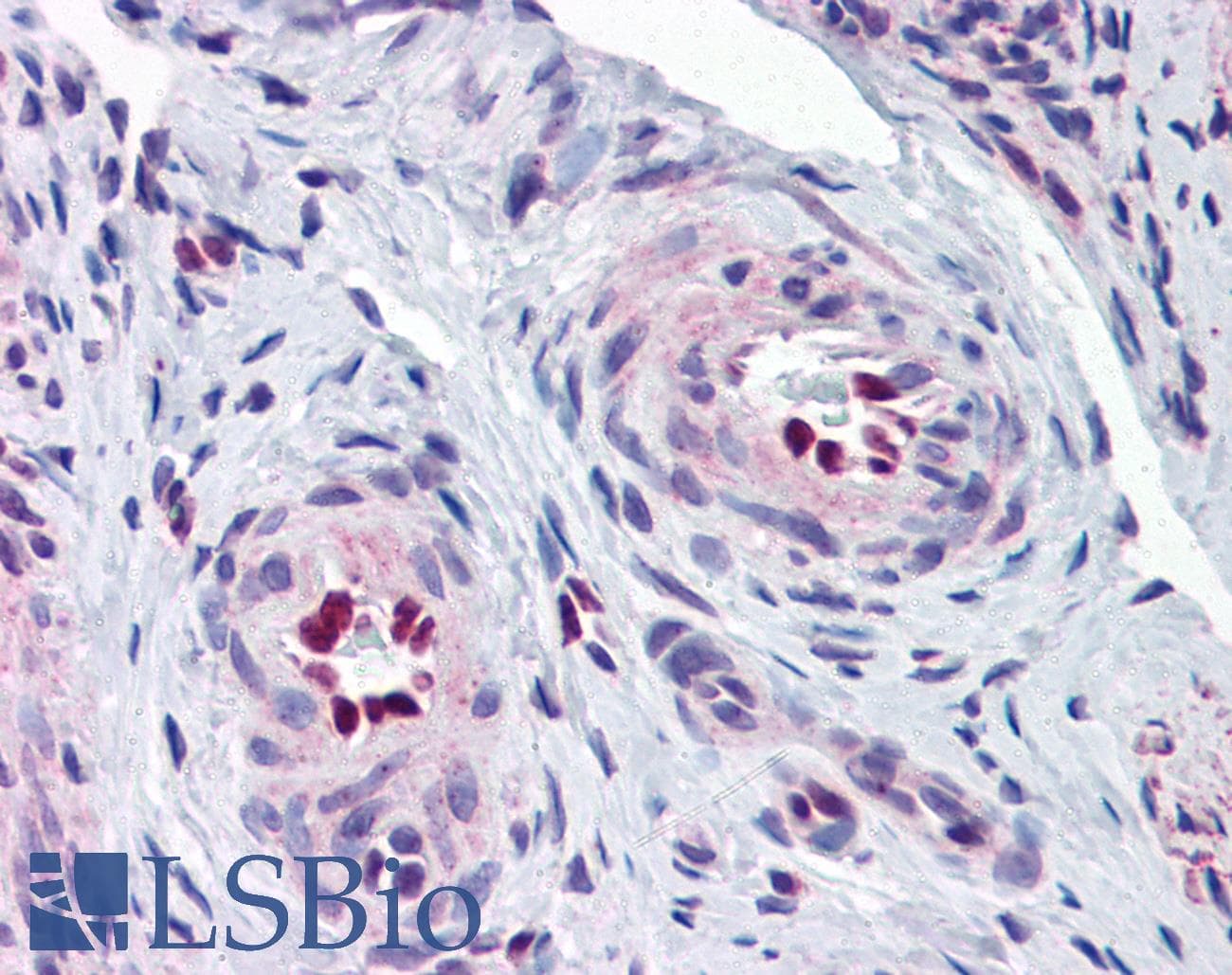 IHC-plus™ Polyclonal Rabbit anti-Human IL-33 Antibody (IHC, IF, WB)